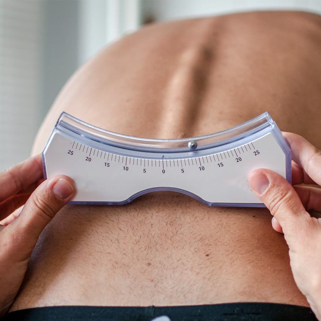 OPCA Parker Scoliosis Bracing - Bracing for Adults and Kids