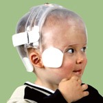 OPCA Parker Pediatric Cranial Remolding Helmet - STARlight Bivalved Helmet