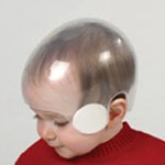 OPCA Parker Pediatric Cranial Remolding Helmet - STARlight Cap Helmet