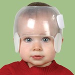 OPCA Parker Pediatric Cranial Remolding Helmet - STARlight Helmet