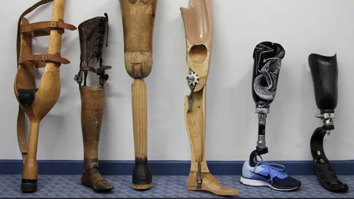 OPCA Orthotic and Prosthetic Parker - Prosthetic Legs