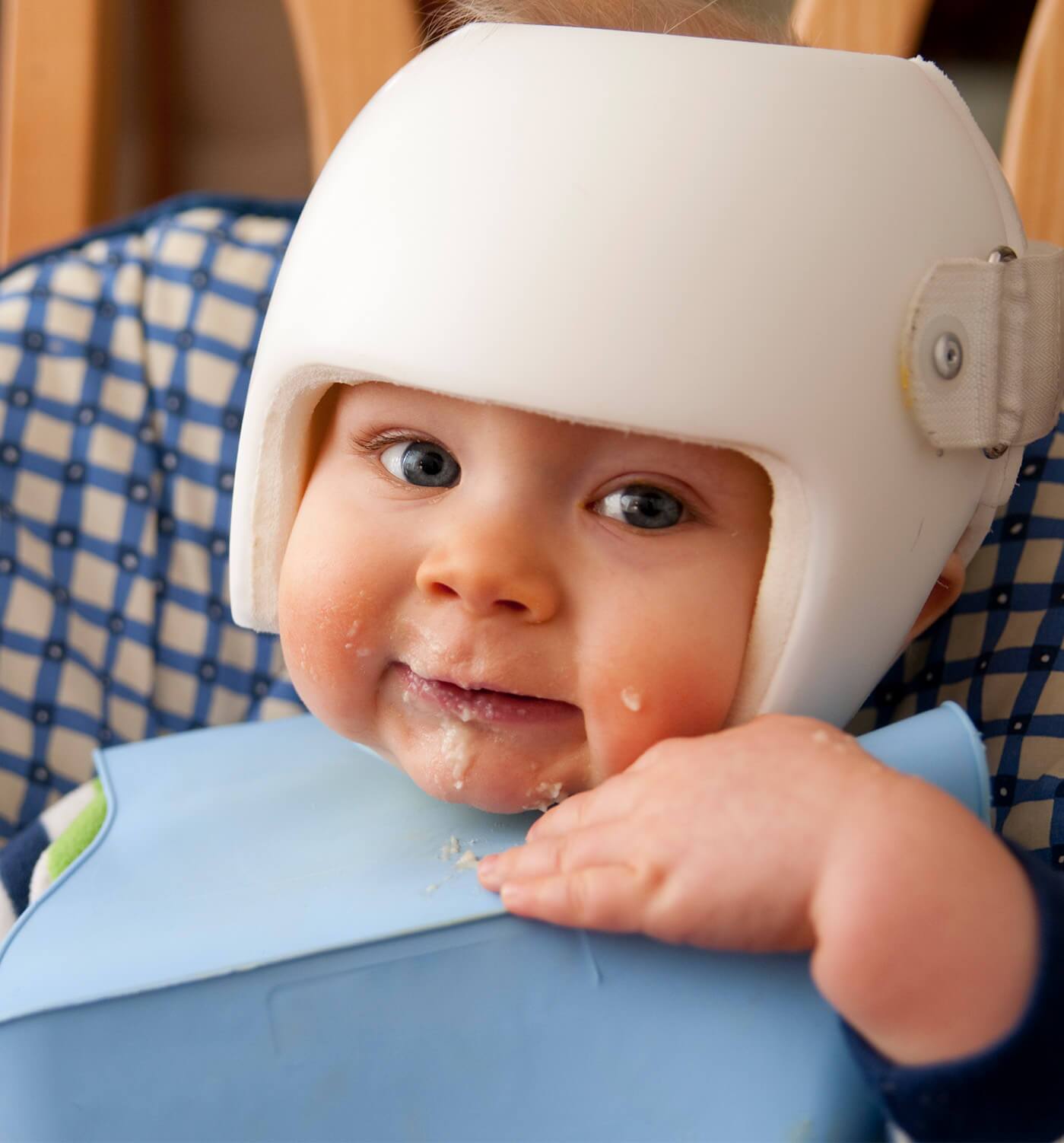 Child wearing a cranial remolding helmet
