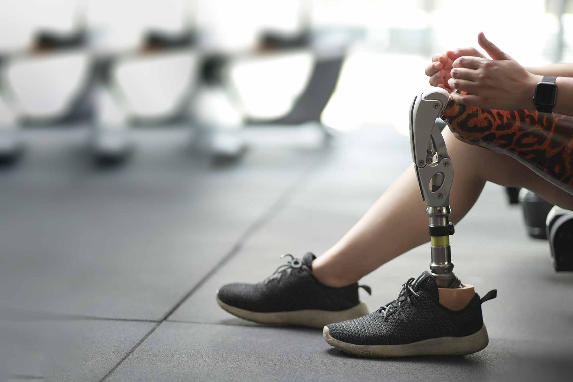 OPCA Parker Orthotic Prosthetic Care – Prosthetic Leg Patient walking with a custom prosthetic leg