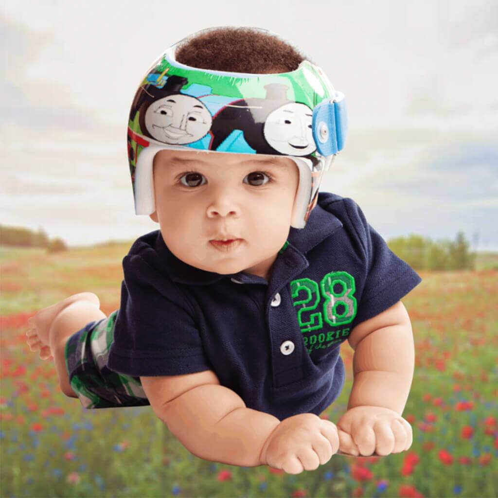 Comfortable pediatric cranial helmet fitting
