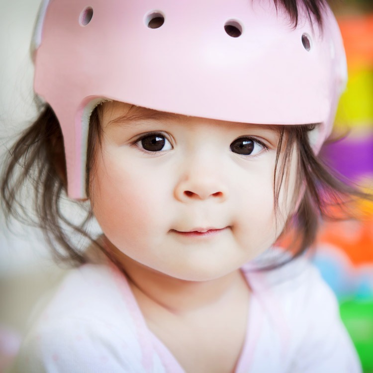 Young child wearing a pink cranial remolding helmet