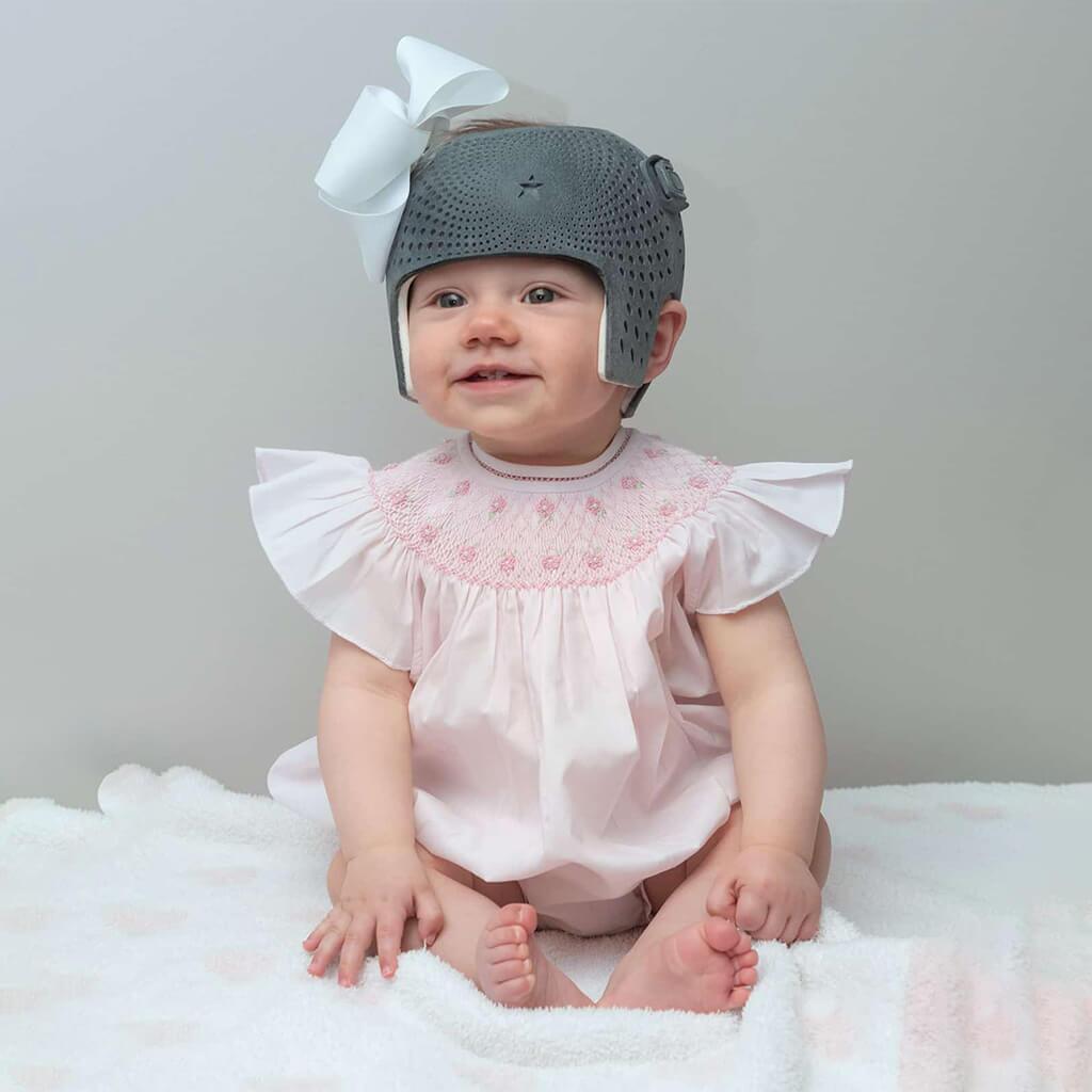 Baby wearing a safe and effective cranial remolding helmet