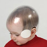 OPCA Parker Pediatric Cranial Remolding Helmet - STARlight Cap Helmet